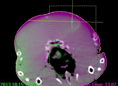 CBCT to Verify Surface Mapping