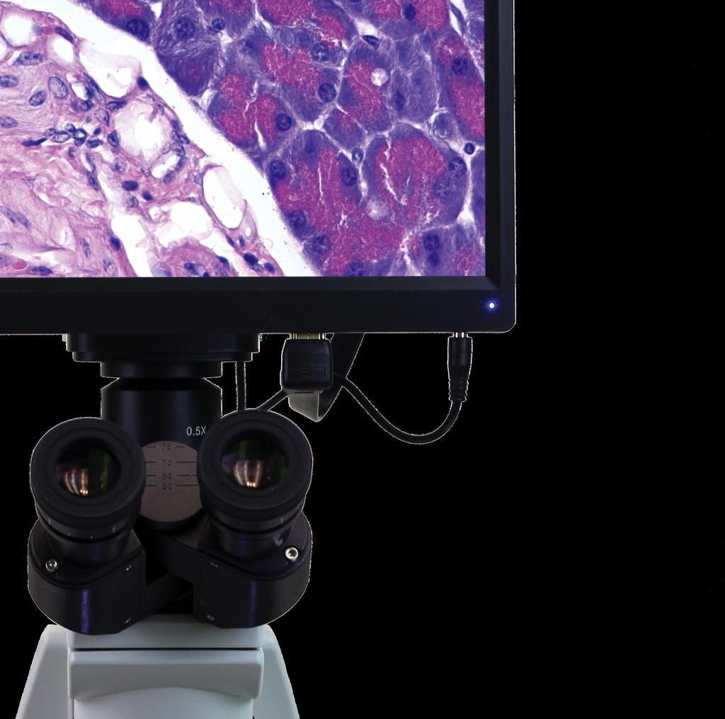 Advanced Digital Imaging Solution The VetScan HDmicroscope is the