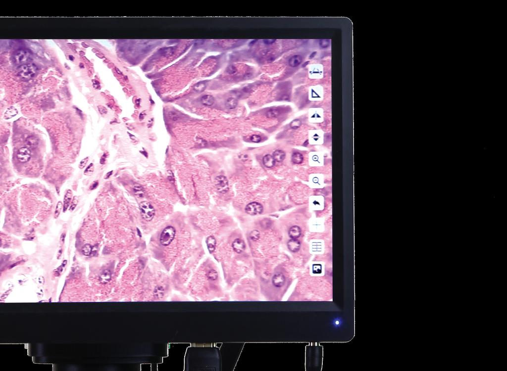 And the incredibly efficient 3D noise reduction performance delivers detailed low light images making the HDmicroscope the optimal choice for flourescence applications.