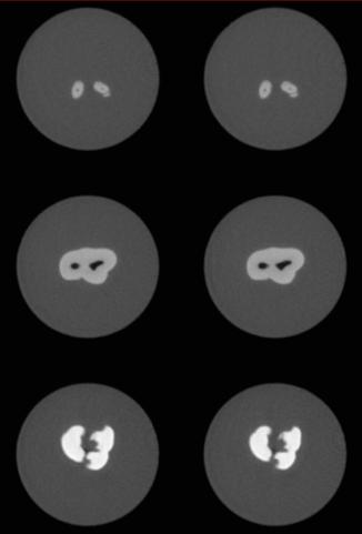Transfer Functions Tooth data surrounded by a circle of dark gray. In the first four samples, there is a black color region inside the tooth.
