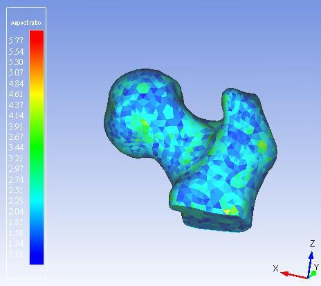 Volumetric mesh 1.09 < Aspect Ratio <3.87 Result: 3D Patient s mesh 1.