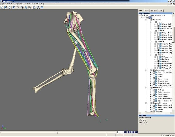 simulation More accurate, less invasive Minimization of the surgical risk Subject-specific muscle-skeletal model for the prediction of muscleforces during gait.