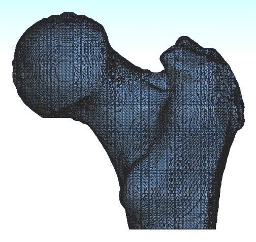 Method Overview Input: 3D FE generic mesh Patient s geometry User-defined anatomical landmark points Generic Mesh Method Patient s