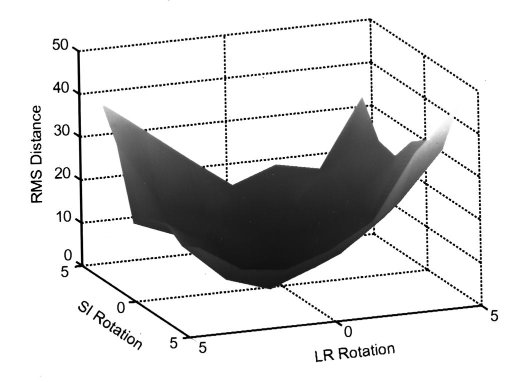 705 Lujan, Balter, and Ten Haken: Rotations in three dimensions 705 FIG. 2. The general procedure for estimating 3-D rotation of a patient using a reference database.