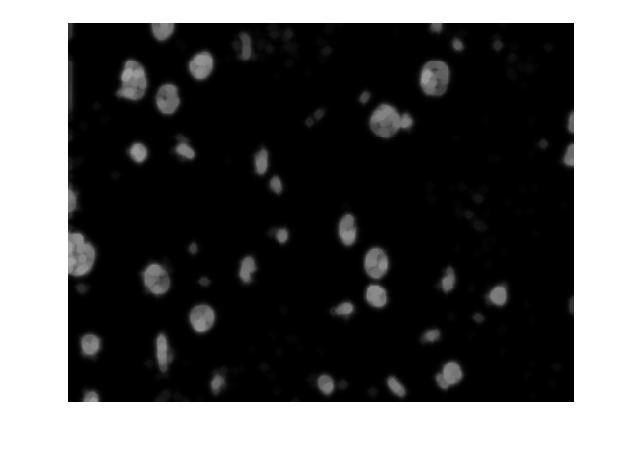 A useful output would be a black and white image that indicates areas where nuclei are likely to be. To accomplish this, something similar to a blurring is needed.