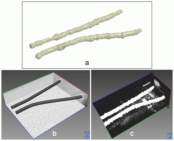 Evaluation of the segmentation algorithm by comparison with a gold standard We assume that the phantom tube geometrical features may deform during the building (weight of the gelatine) and through