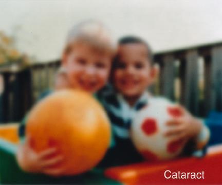 Vision Impairments Cataracts Photos courtesy of National Eye Institute http://www.nei.nih.