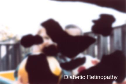 Vision Impairments Diabetic Retinopathy Photos courtesy of National Eye Institute http://www.nei.nih.