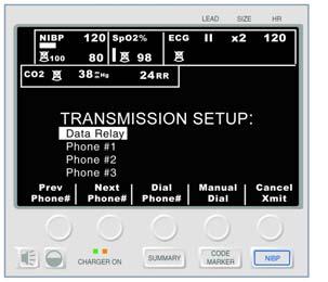 Data Transmission Step Action Result 3. Press the Patient Records softkey. The M Series unit displays the Patient Records menu.
