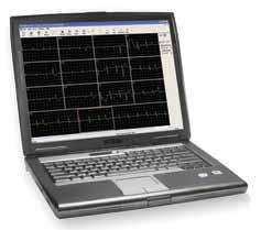 76 / ECG MACHINES PC-Based 12 Lead ECG Clean trace & comprehensive reporting An advanced paperless ECG solution Software Features Easy interface to Medical Director and other EMR