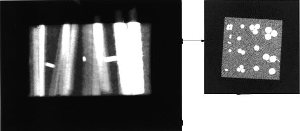 Finding many bars Radiographic (left) and CT (right) image. H.E. Martz, D.J.