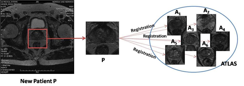 Atlas Based Segmentation of the prostate in MR images 3 Fig.1.