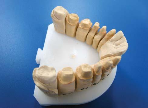 Product Profile Fig 11. Ten unit crown and bridge model ready to be scanned. Figure 12. Maestro 3D OrthoScan can acquire any type of dental model with a high level of accuracy.