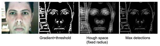 Hough Transform: Circle Detection Iris detection [Source: K.
