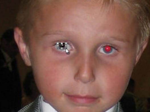 149 Red-Eye Red-Eye is a common problem with when taking pictures of people. A camera flash in just the right (or wrong) spot and now your family members all have glowing red eyes.