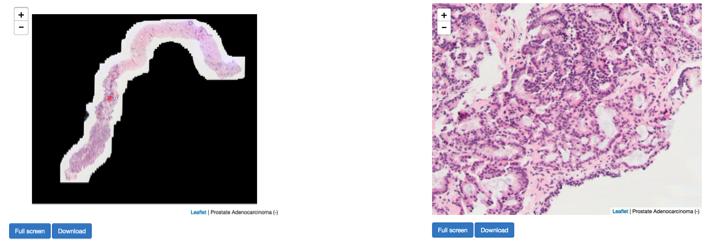 Pathobin Mosaic software The Pathobin Mosaic software is an affordable manual whole slide scanner solution that works with the Pathobin C-mount Camera or other standard microscope cameras*, allowing