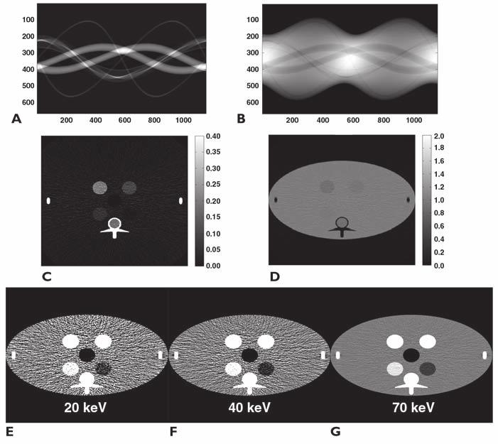Yu et al. In this article, we summarize how virtual monochromatic images are synthesized from dual-energy CT, using either image-domain or projection-domain methods.