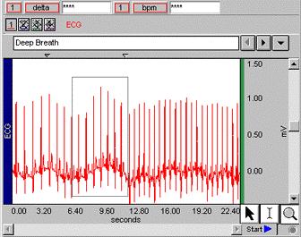 PRO Tutorial 23 Zoom Tool 67. Select the Zoom Tool in the lower right corner of the graph window. 68. Click, drag, and release the Zoom tool in a waveform to select and magnify a section of data. 69.