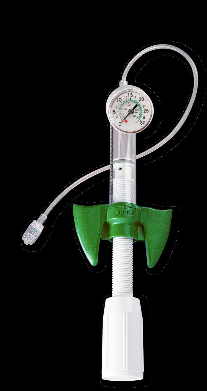 25cc clear polycarbonate syringe barrel permits easy debubbling. Winged locking mechanism permits easy deflation at high pressures.