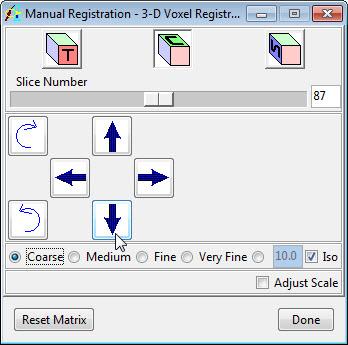 Exercise 39 : Image Registration Mutual Information Registration This exercise will demonstrate how to adjust a 3-D registration starting position to achieve an optimal registration of two 3-D volume