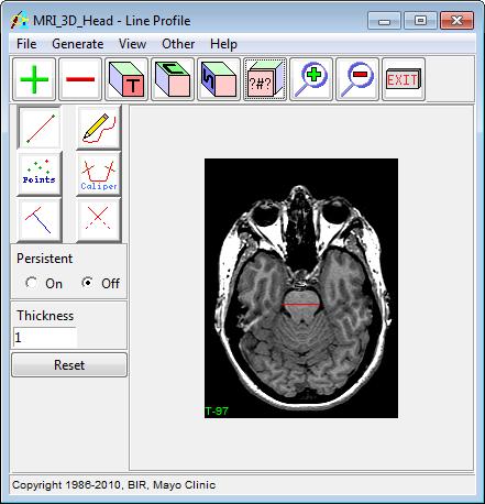 Exercise 40 : Line Profile Calculating Image Intensities Along a Straight Line The Line Profile module enables calculation of image intensities along straight lines and freehand traces.