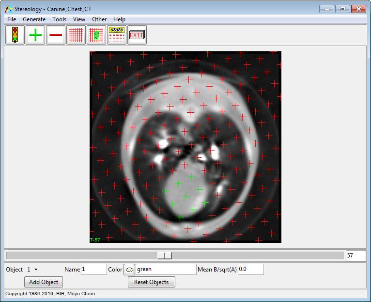 within the feature of interest. 1. Load the Canine_Chest_CT.avw data set from the $:\BIR\images\TutorialData directory. 2. Open the Stereology module (Measure > Stereology). 3.