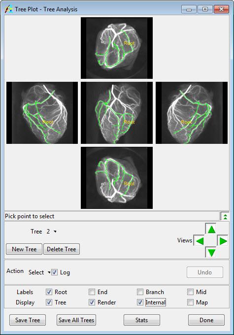Exercise 48 : Tree Analysis in Depth Examination of Coronary Arteries 1. Generating a Fly-Through Movie Additional Task 1. Check Internal from the Display options in the Tree Plot window (figure 1).