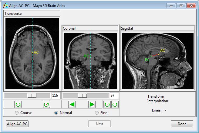 Exercise 50 : Mayo 3D Brain Atlas The Analyze Mayo 3D Brain Atlas add-on provides a unique 3D implementation of the Talairach anatomical atlas of the human brain.