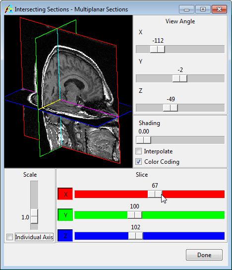 Exercise 8 : Multiplanar Sections Scan Tool 6. The Scan Tool (Tools > Scan) provides an interface for slice-by-slice review.