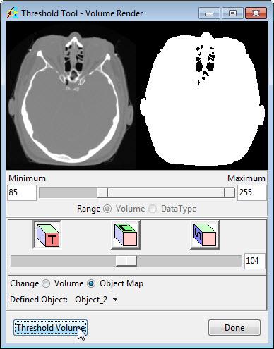 Object maps are special image files that are used in Analyze to partition and identify structures as belonging to a particular segmented object.