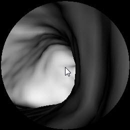 When you reach the bifurcation of the airway, click in the right bronchus.