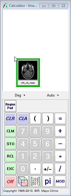 Exercise 24 : Image Calculator SubRegion Data The Image Calculator module performs mathematical operations on volumes, matrices and constant numerical values.