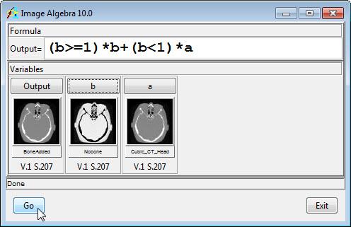 Once processing is complete, right-click on the Output icon and select Display to examine the data with bone removed. 14.