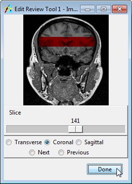 With the Auto Trace tool selected, continue to segment slices by clicking Apply & Advance in the main Image Edit window. Segment the brain on 20 slices (to slice 142).