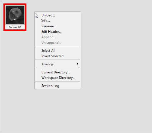 Analyze Basics Right Mouse Button Menu The Analyze workspace is an area with additional options. When the right mouse button is clicked in the workspace, a menu will appear.