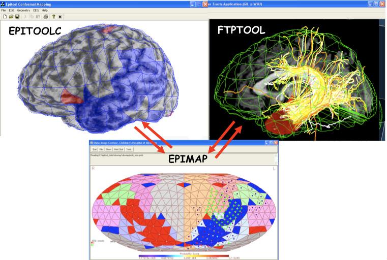Processing pipeline for geometry-based integrative analysis of brain imaging data.