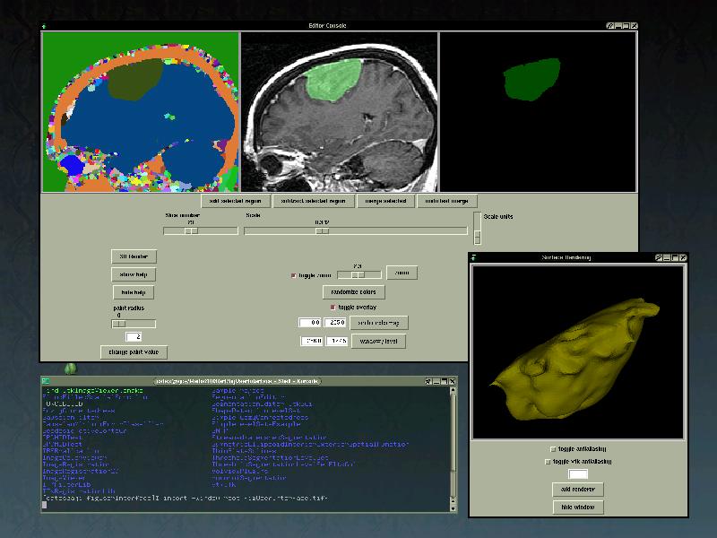 Watershed GUI (Cates `05) Watershed transform Data with overlay Segmentation in progress Sliders
