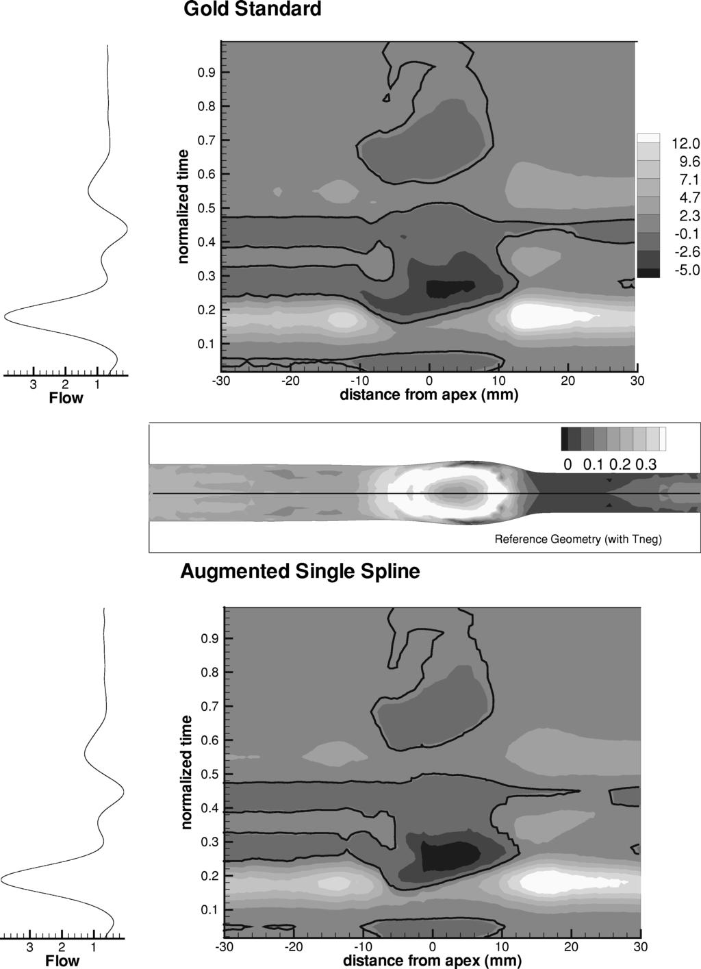 Accuracy of Hemodynamic Modeling 39 FIGURE 6. Variation in normalized wall shear stress magnitude along the lateral centerline of the internal carotid artery sinus under pulsatile flow conditions.