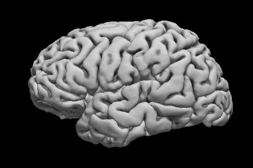 Example Results Brain Surface Model