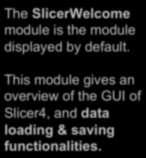 Slicer4 Minute Tutorial: Welcome Module The SlicerWelcome module is the module displayed by default.