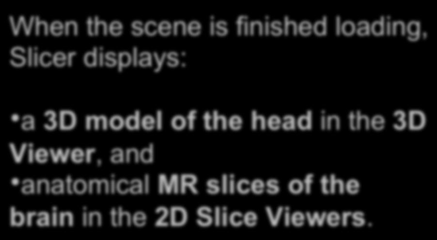 Slicer4 Minute Tutorial: Viewing the Scene When the scene is finished loading, Slicer displays: 3D Viewer a 3D model of