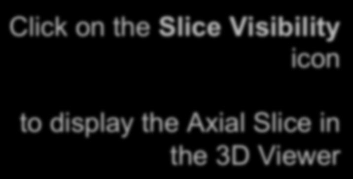 Slicer4 Minute Tutorial: Viewing Slices in the 3D Viewer Click on the Slice