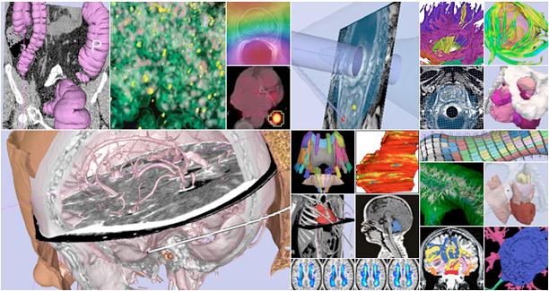 3D Slicer is An end-user application for image analysis and visualization An open-source environment for software