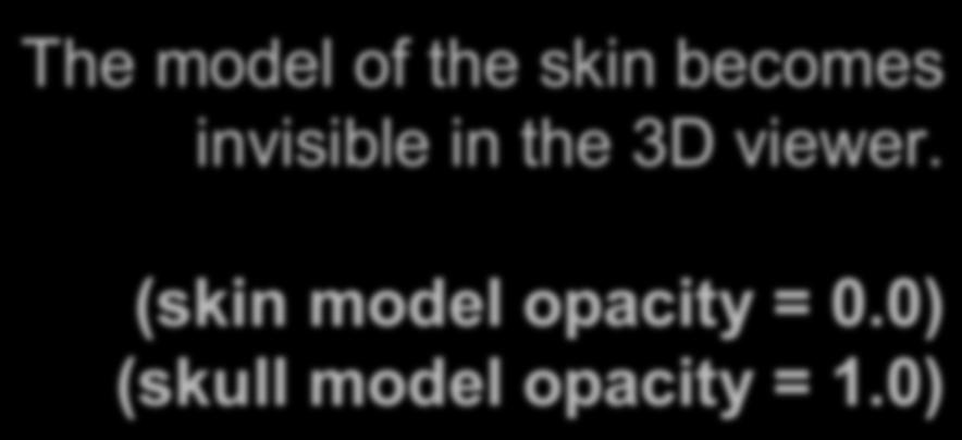 the 3D viewer. (skin model opacity = 0.