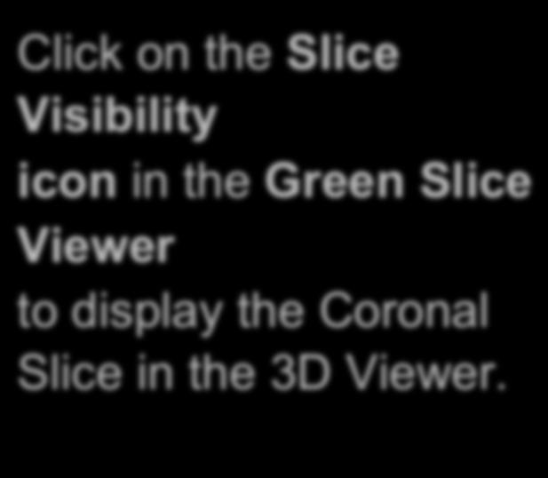 Slicer4 Minute Tutorial: 3D Visualization Click on the Slice Visibility icon in the