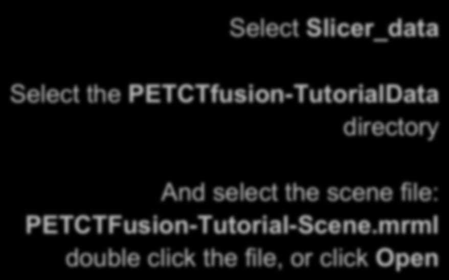 PET/CT Visualization and Analysis: Load the new scene Click on the Load Scene icon Select Slicer_data Select the