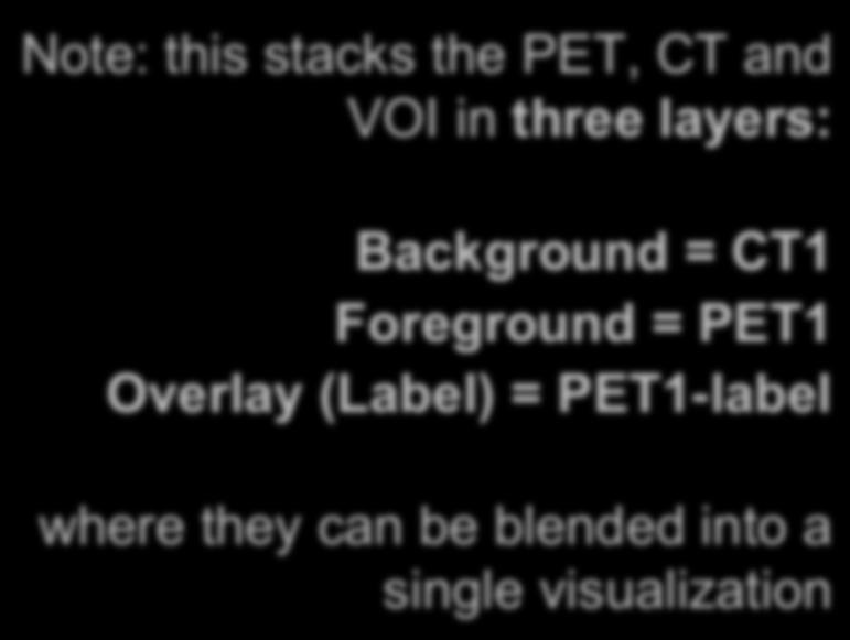PET/CT Visualization and Analysis: Information displayed in Layers Note: this stacks the PET, CT and VOI in three layers: