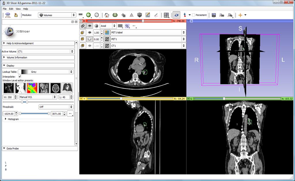 PET/CT Visualization and