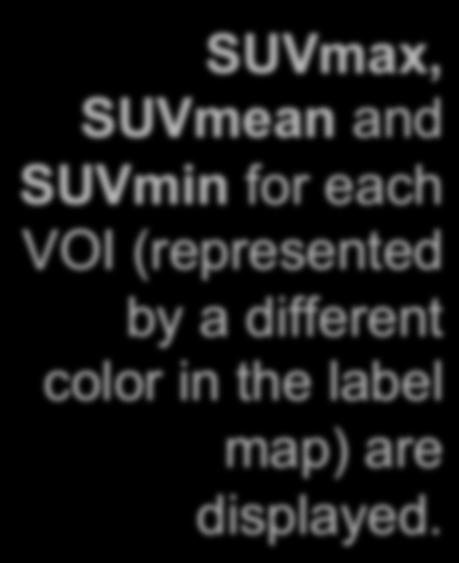 SUVmin for each VOI (represented by a different