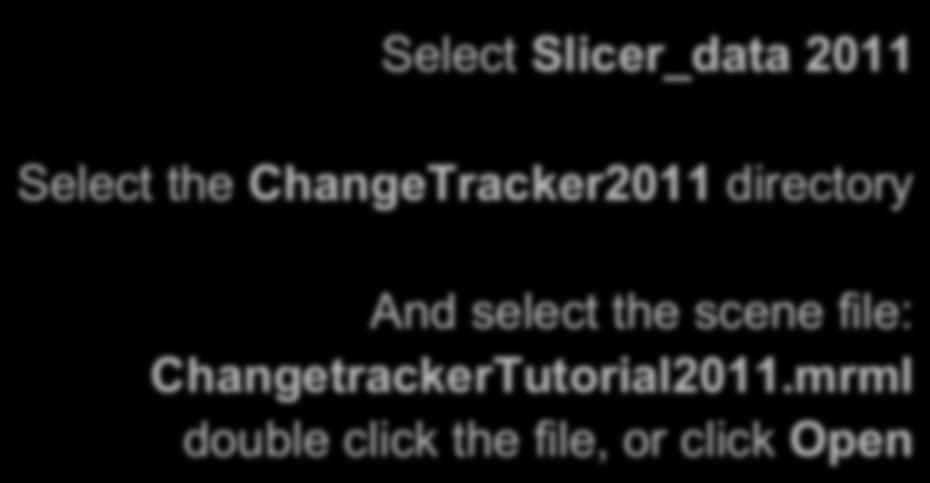 ChangeTracker: Load the dataset Click on the Load Scene icon Select Slicer_data 2011 Select the ChangeTracker2011